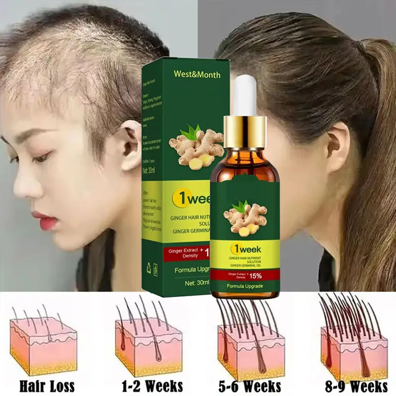 Licorice Root Sticks - 생강 모발 성장 제품, 빠른 모발